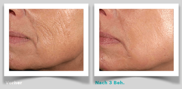 Gesichtsmodellierung
