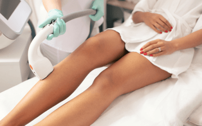 Haarentfernungslaser: Welche Methoden gibt es?