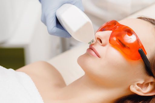 haarlaser Haarlaser